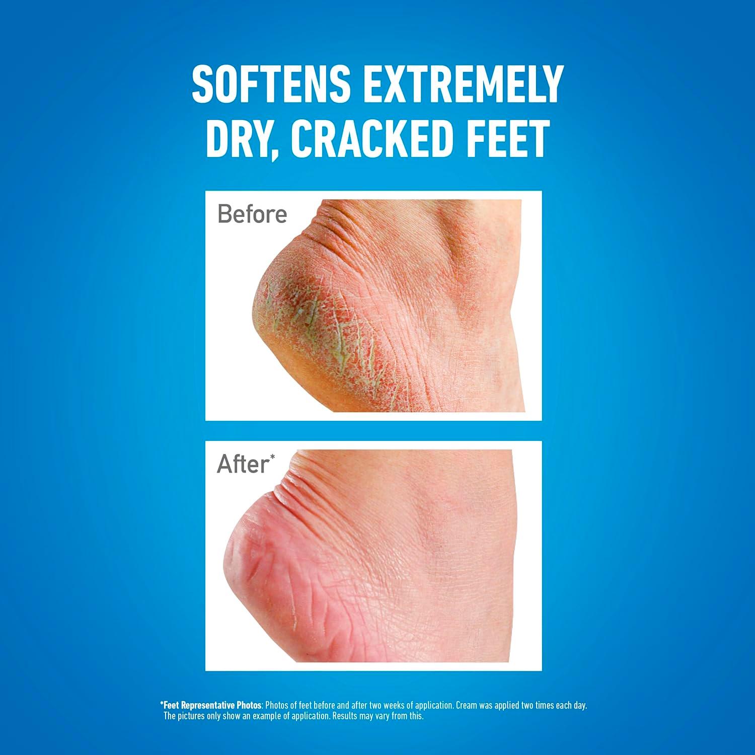 O'Keeffe's for Healthy Feet Exfoliating Moisturising Foot Cream 85ml thumbnail 5