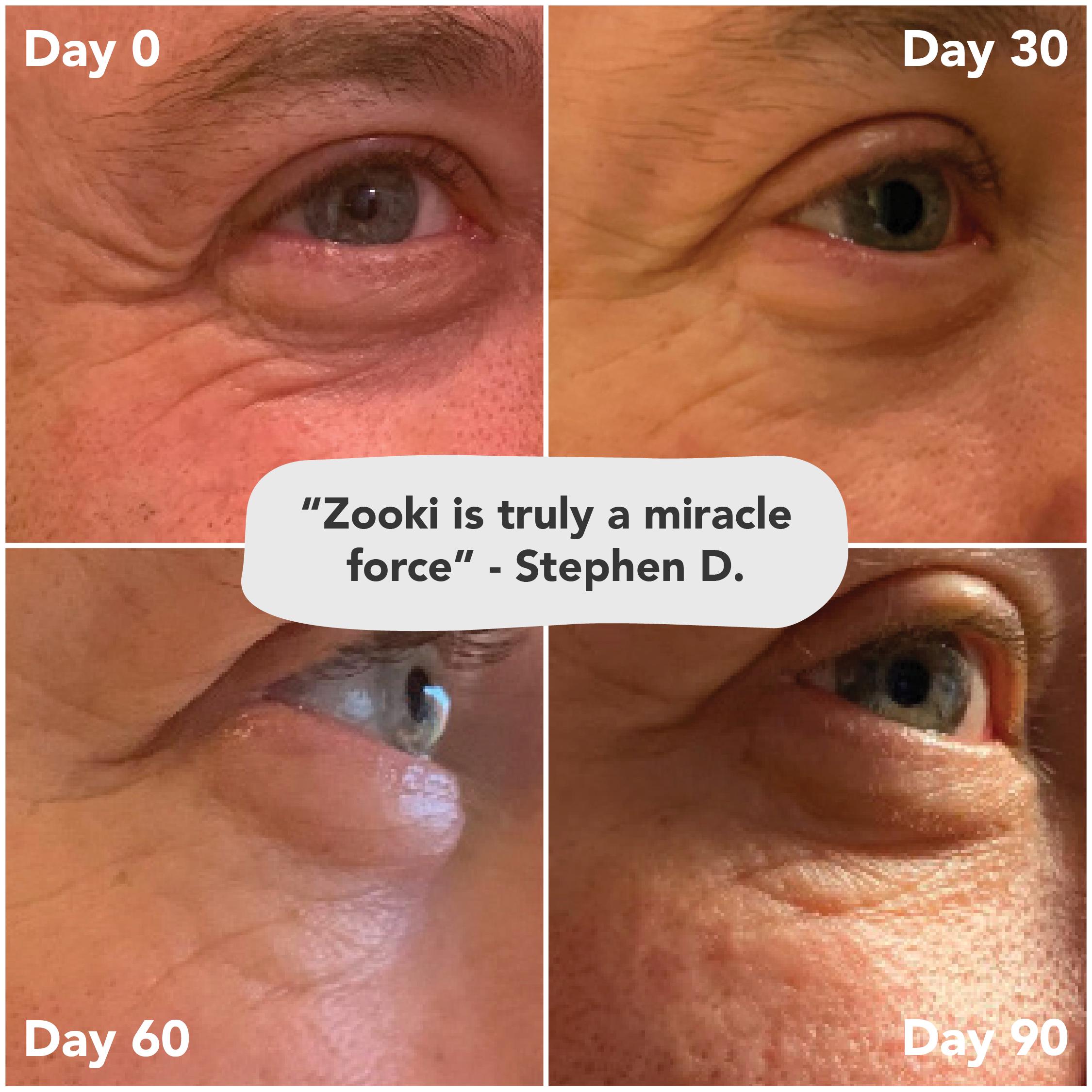 Zooki Collagen Mango Peach Food Supplement 15ml thumbnail 5