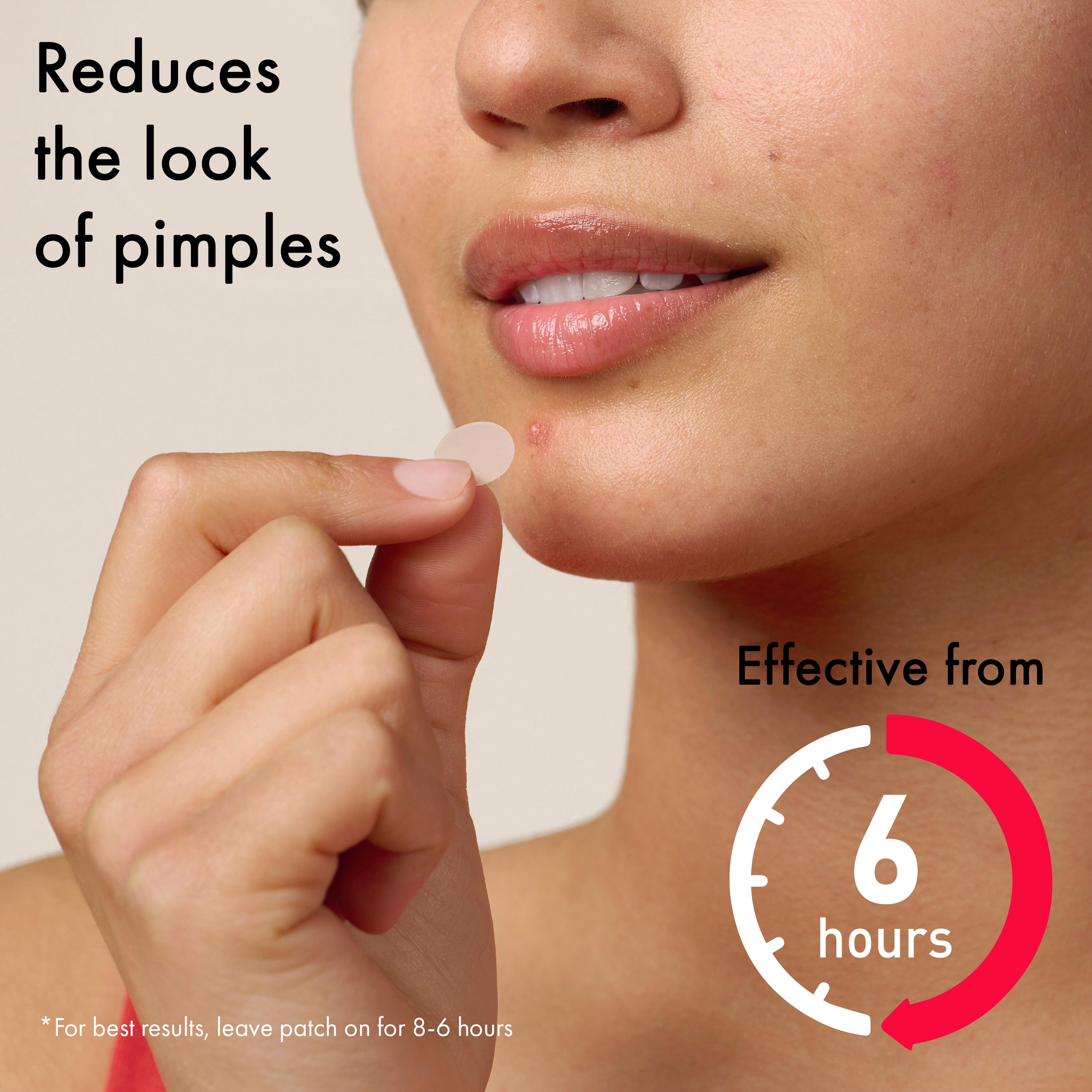 Mighty Patch Duo Pimple Patches From Hero Cosmetics Pimple Patches x12 thumbnail 2