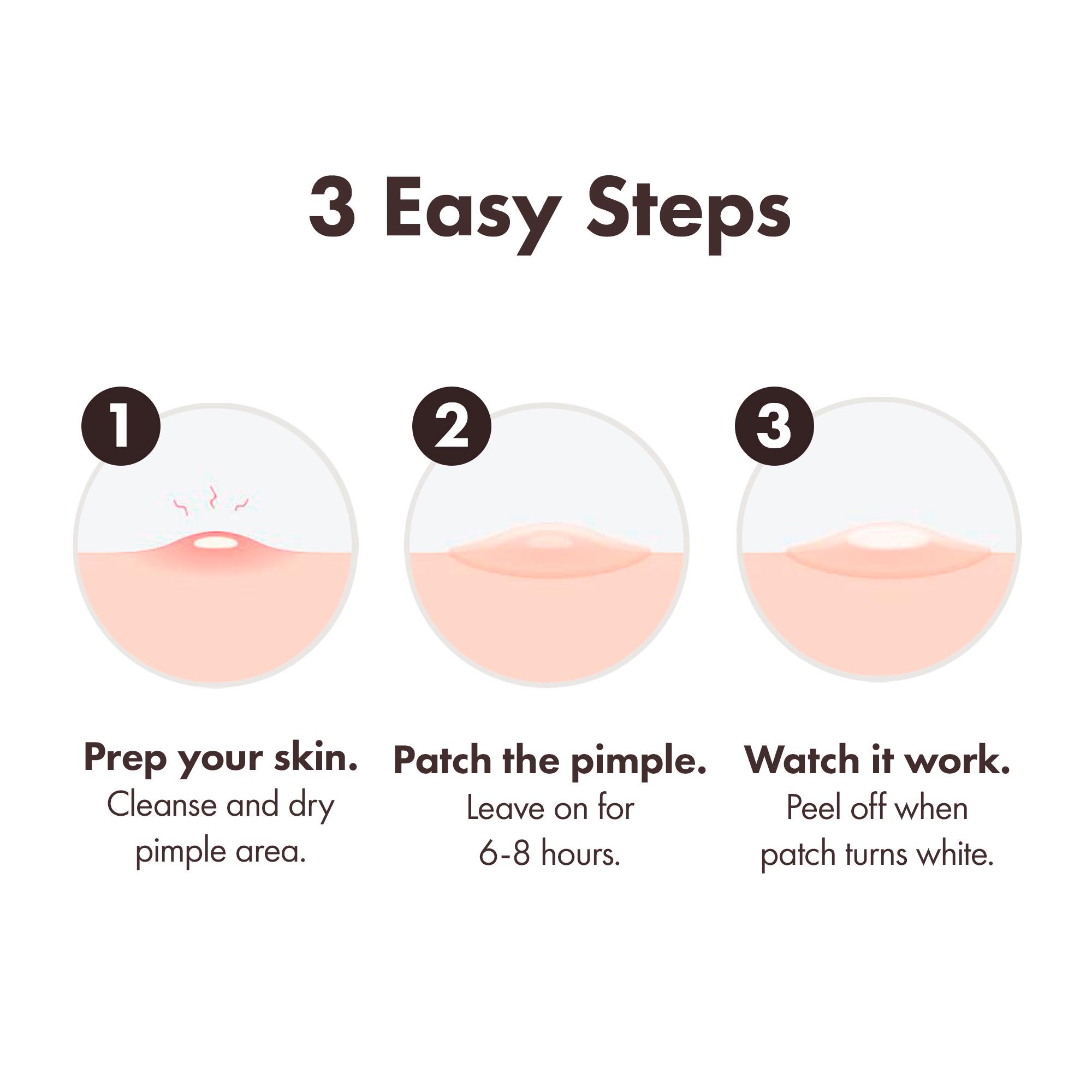 Mighty Patch Duo Pimple Patches From Hero Cosmetics Pimple Patches x12 thumbnail 5