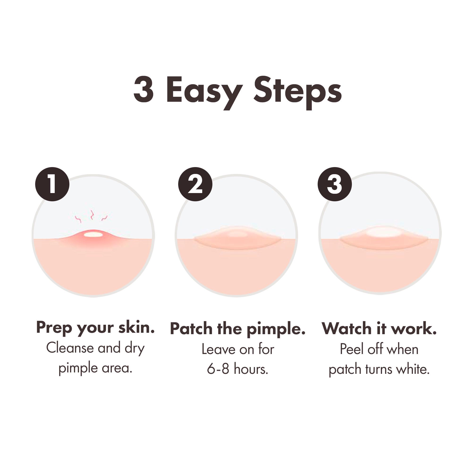 Mighty Patch Invisible+ Spot Patches by Hero Cosmetics Pimple Patches x24 thumbnail 5