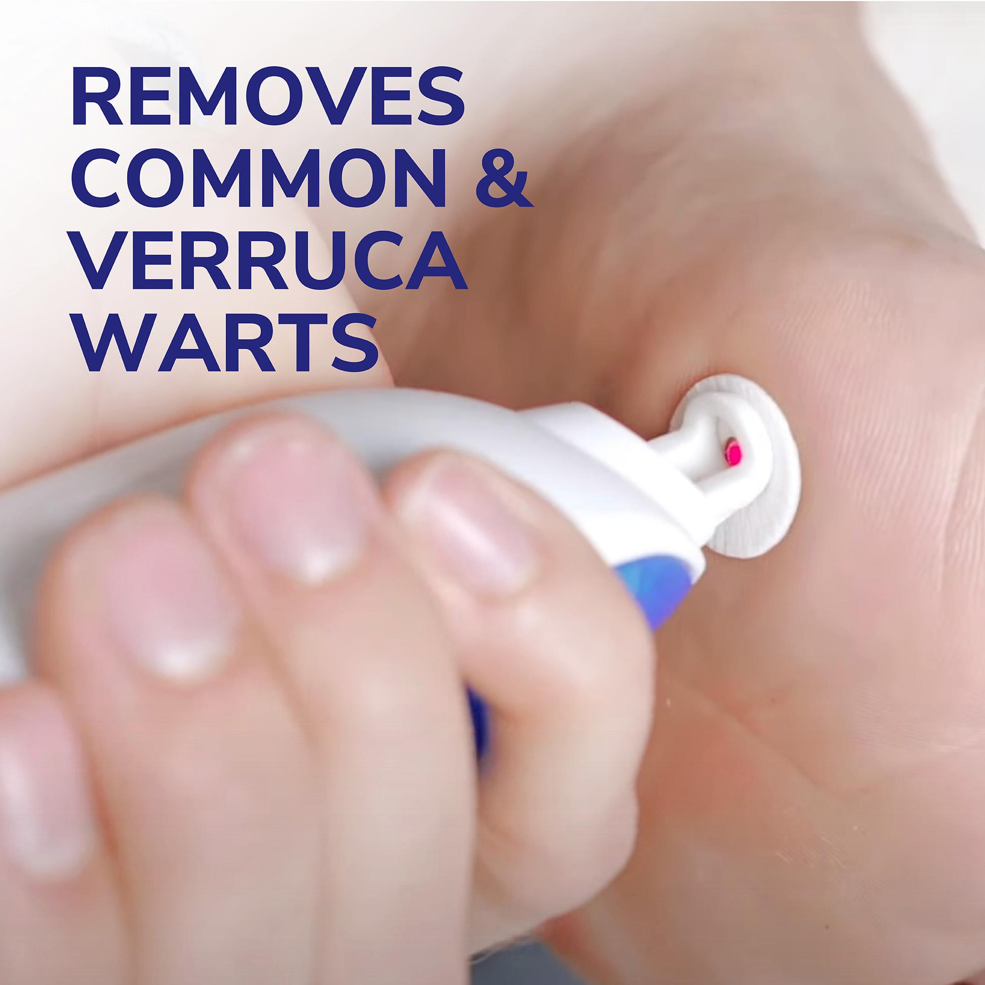 Dr. Scholl's Freeze Away Max Verruca & Wart Remover 35ml thumbnail 2