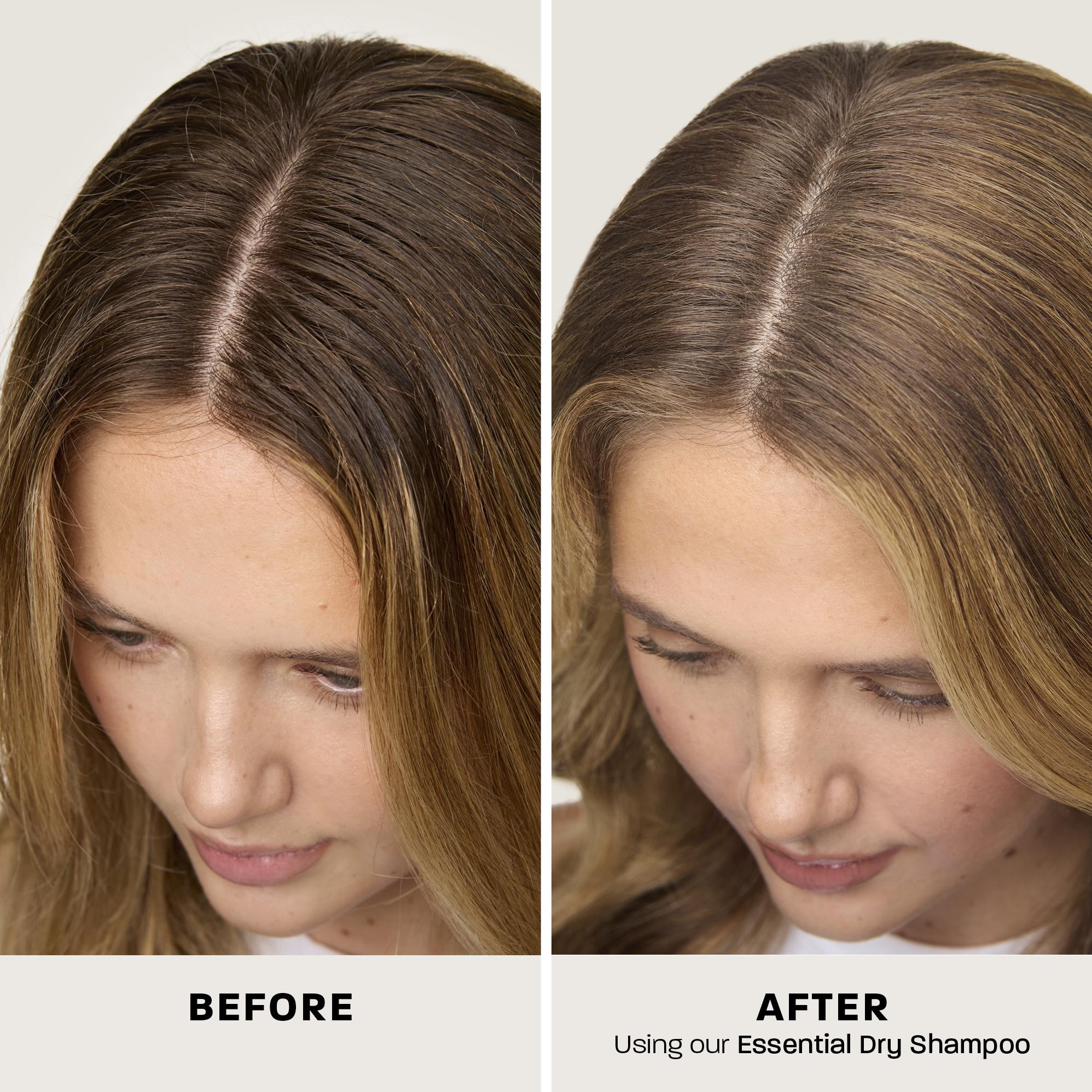 Rehab Essential Dry Shampoo 50g thumbnail 5