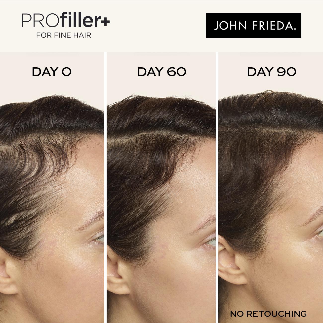 John Frieda Profiller+ Hair Growth Scalp Serum 50ml thumbnail 5