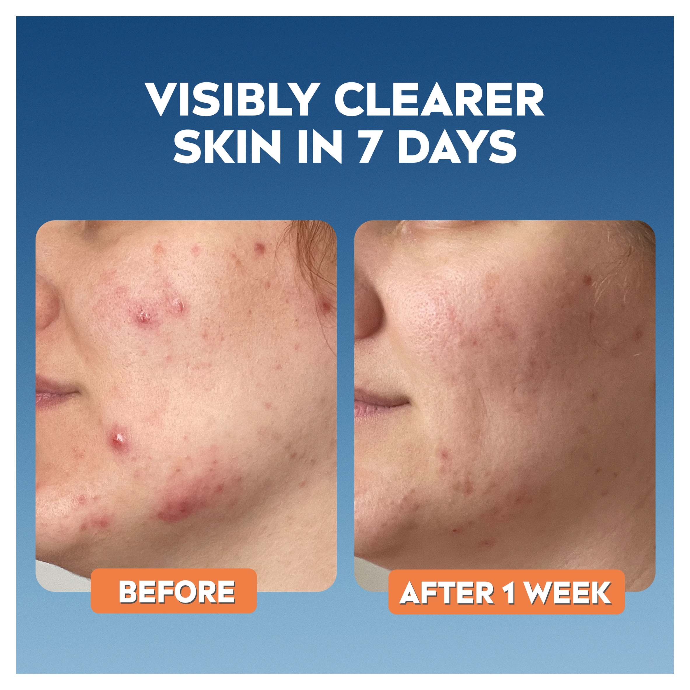 NIVEA Derma Skin Clear Toner 200ml thumbnail 2