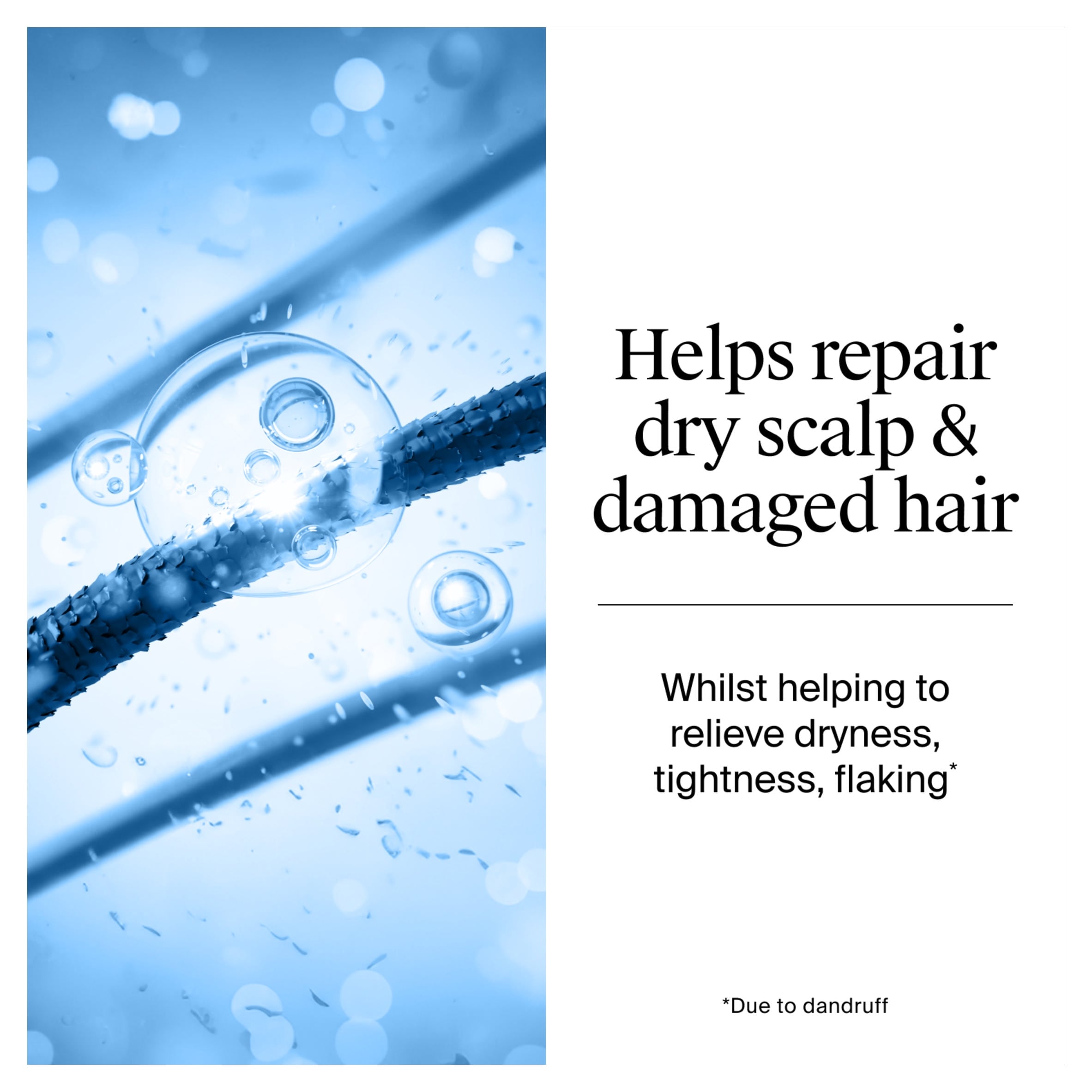 Neutrogena T/Gel Anti-Dandruff Dry Scalp Shampoo 250ml thumbnail 4