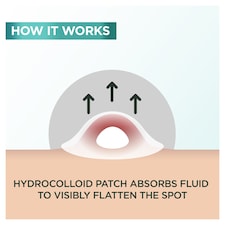 Garnier Pure Active Blemish Patch 22 Pack thumbnail 4