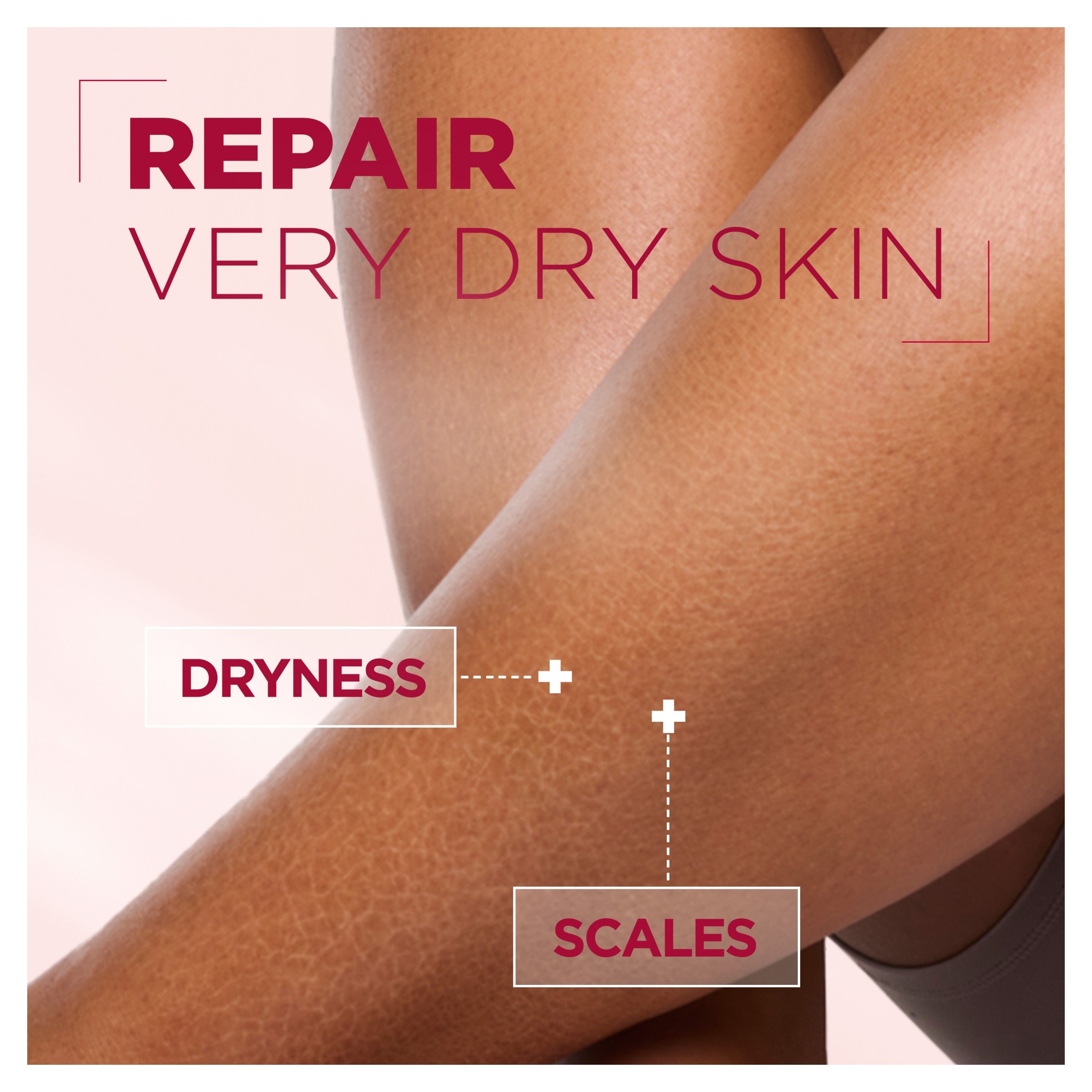 Mixa Body Urea Cica Repair+ Lotion 400ml thumbnail 3