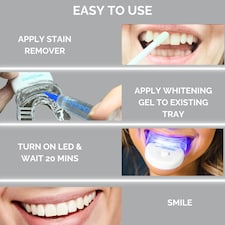 Smile Science Harley Street Teeth Whitening Treatment Kit thumbnail 3